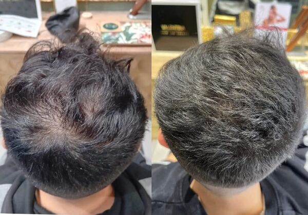 Valentina Trico Hair Lab Milano