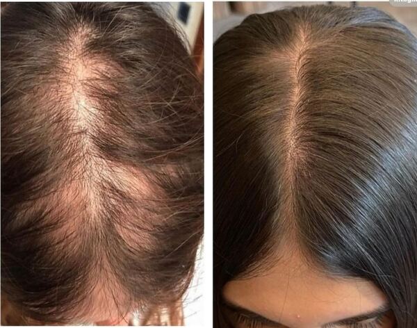Valentina Trico Hair Lab Milano